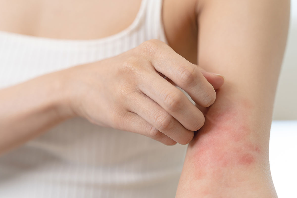 Skin Rashes Can be Treated Virtually.